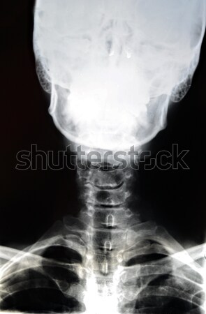 X-Ray of Lower Skull and Neck Stock photo © 2tun