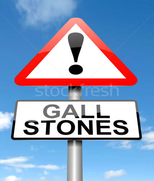 Gall stones concept. Stock photo © 72soul