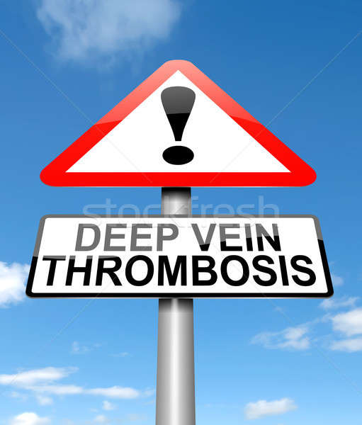 Stock photo: Deep vein thrombosis concept.