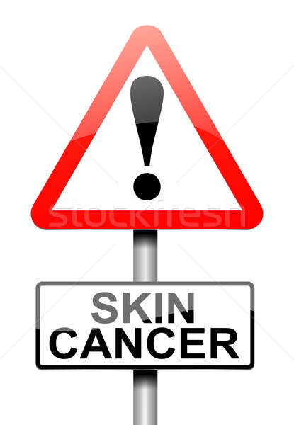 Cancer de piele ilustrare semna creştere cancer fundal alb Imagine de stoc © 72soul