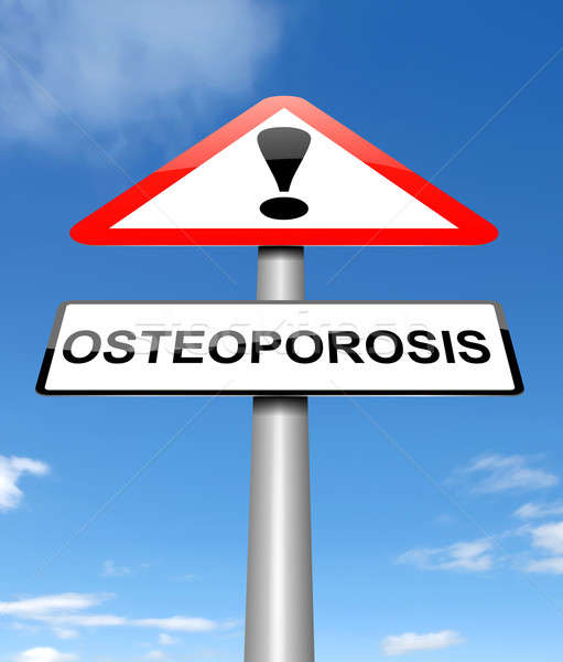Osteoporoza ilustracja podpisania zdrowia graficzne pojęcia Zdjęcia stock © 72soul