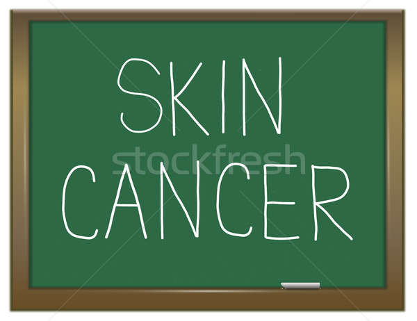 Cancer de piele ilustrare verde tabla grafic concept Imagine de stoc © 72soul