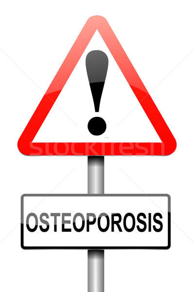 Osteoporoza ilustracja podpisania zdrowia graficzne białe tło Zdjęcia stock © 72soul