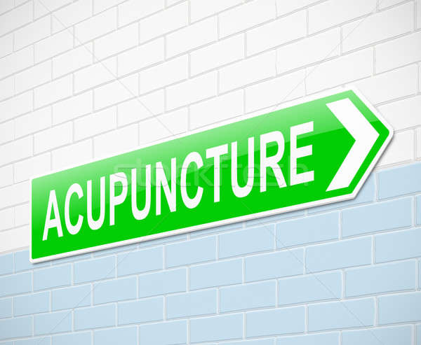 Acupunture concept. Stock photo © 72soul