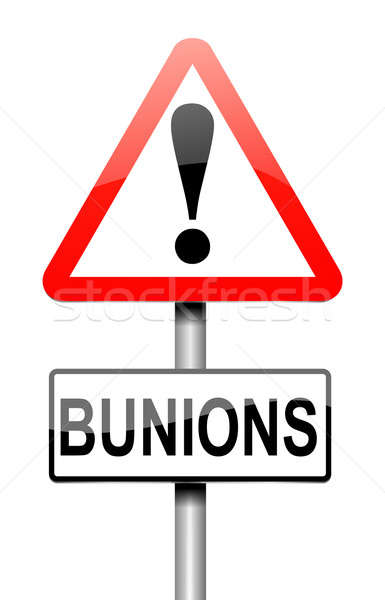 Bunions concept. Stock photo © 72soul