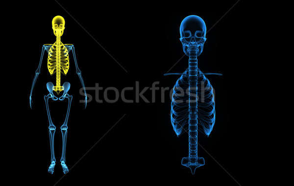Kafatası kaburga kafes kemikleri tüm Stok fotoğraf © 7activestudio