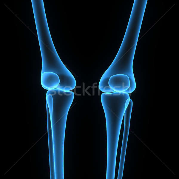 Skeleton knees Stock photo © 7activestudio