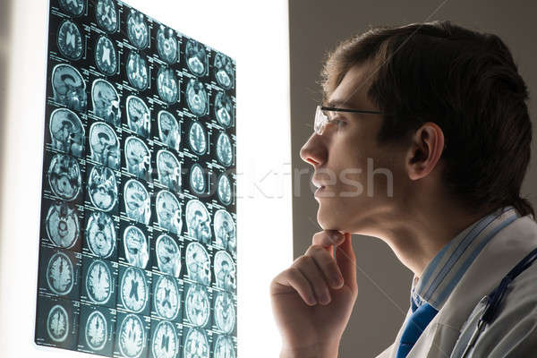 male doctor looking at the x-ray image Stock photo © adam121