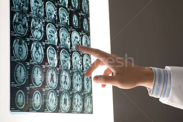 醫生 男 手 圖像 X射線 附 商業照片 © adam121
