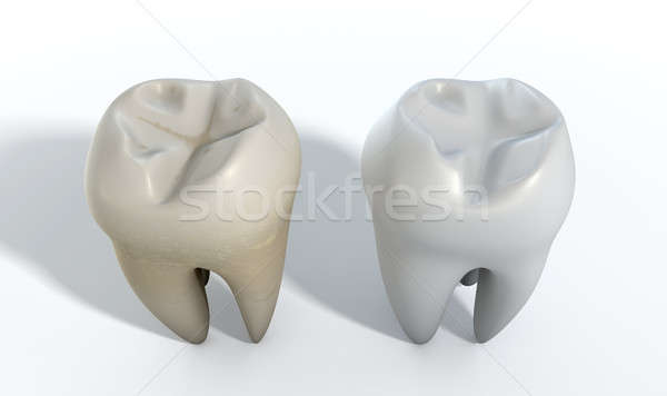 Dirty Clean Tooth Comparison Stock photo © albund
