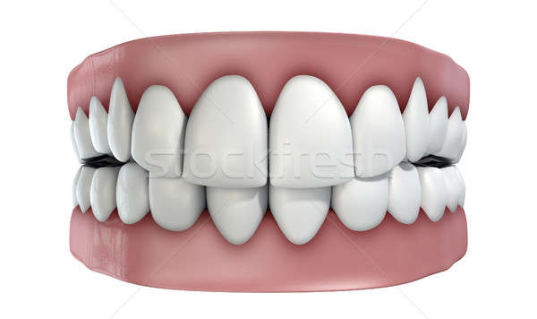 Stock photo: Teeth Set Isolated