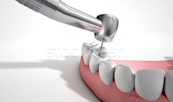 Foto d'archivio: Dentisti · trapano · denti · primo · piano · acciaio