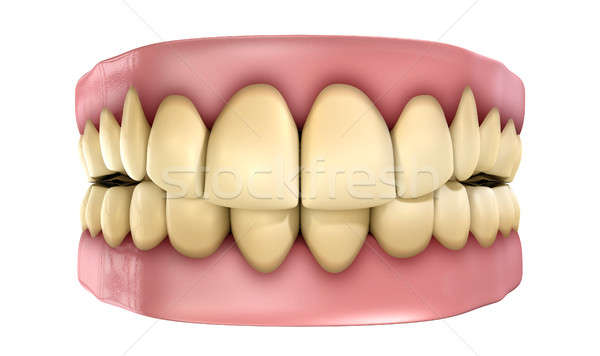 Stock photo: Teeth Set Yellow Isolated