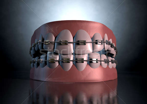 Creepy Teeth With Braces Stock photo © albund