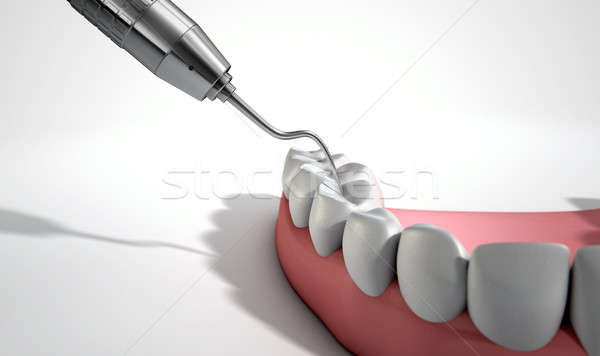 Dentists Probe Hook And Teeth Stock photo © albund
