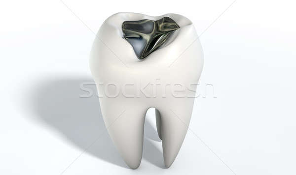 Tooth With Lead Filling Stock photo © albund
