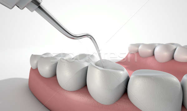 Dentists Probe Hook And Teeth Stock photo © albund