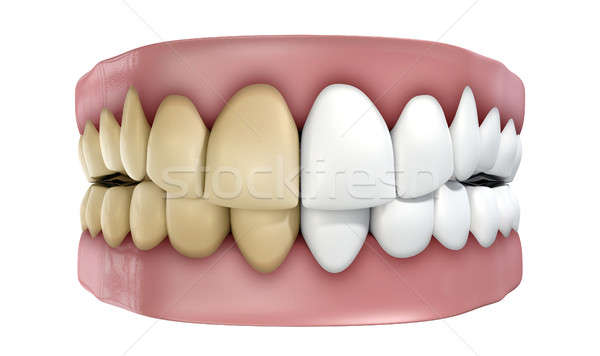 Teeth Set Isolated Stock photo © albund