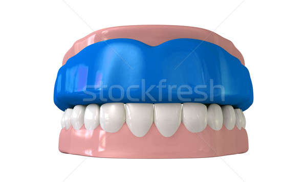 Gum Guard Fitted On Closed False Teeth Stock photo © albund