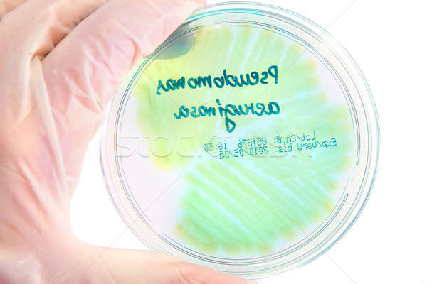 Pathological bacteria  Stock photo © Amaviael