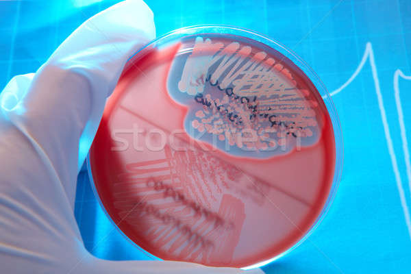 Bactéries main gant plaque verre Photo stock © Amaviael