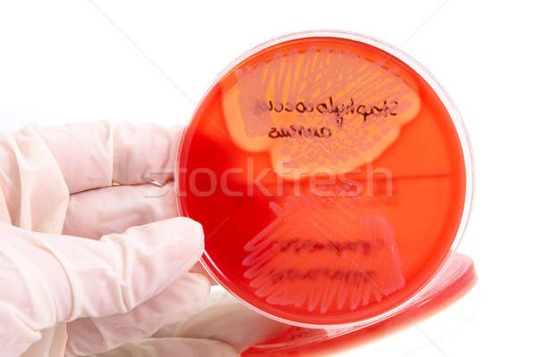 Bakteriler el eldiven plaka yalıtılmış Stok fotoğraf © Amaviael
