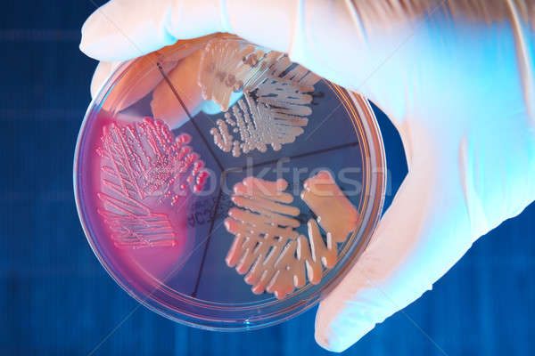 Stock fotó: Baktériumok · kéz · kesztyű · tart · tányér · üveg