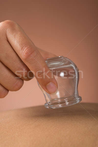 Person Giving Cupping Treatment Stock photo © AndreyPopov