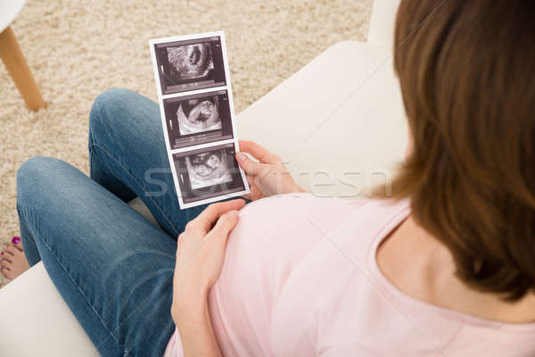 Femme ultrasons image bébé [[stock_photo]] © AndreyPopov