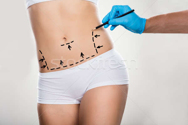 Surgeon Drawing Correction Lines On Woman's Stomach Stock photo © AndreyPopov