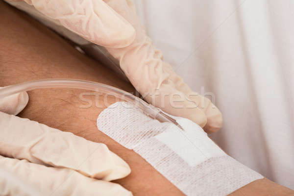 Close-up Of A Iv Drip In Patient's Hand Stock photo © AndreyPopov