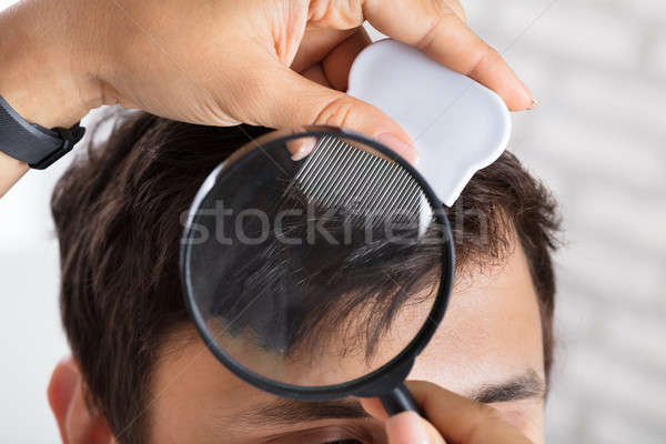 Dermatologist Checking Patient's Hair With Magnifying Glass Stock photo © AndreyPopov