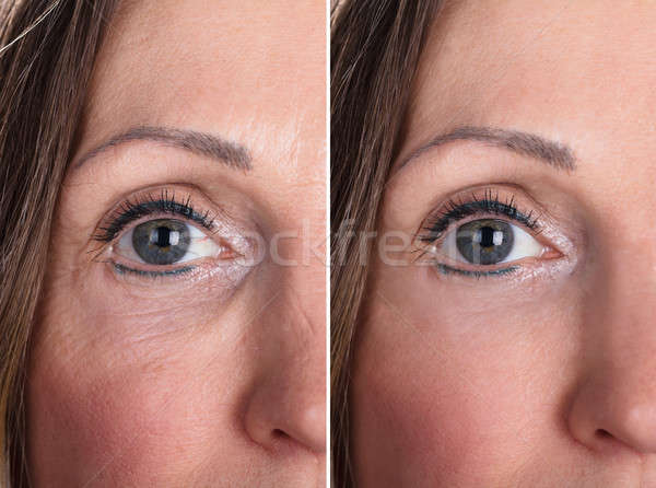 Woman With Before And After Rejuvenation Stock photo © AndreyPopov