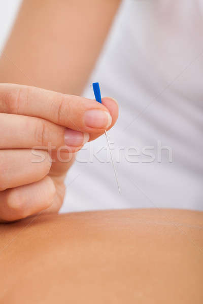 Masażystka igły strony akupunktura Zdjęcia stock © AndreyPopov