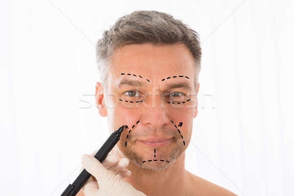 Surgeon Drawing Correction Lines On Man Face Stock photo © AndreyPopov
