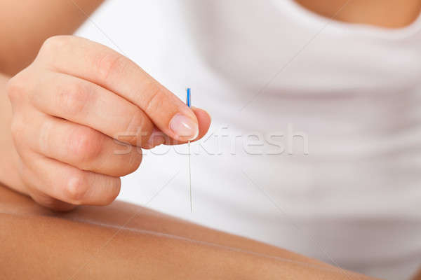 Mano estimulante acupuntura aguja primer plano mujer Foto stock © AndreyPopov