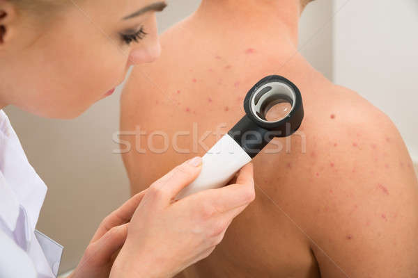 Stock photo: Doctor Examining Pigmented Skin