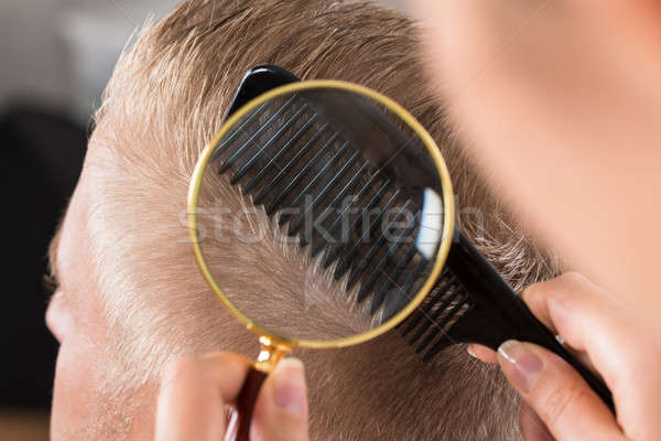 Doctor Looking At Patient's Hair Through Magnifying Glass Stock photo © AndreyPopov
