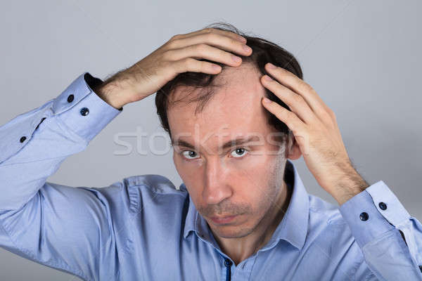 Man Suffering From Hair Loss Stock photo © AndreyPopov
