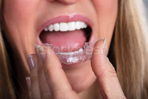 Woman Wearing Clear Aligner Stock photo © AndreyPopov