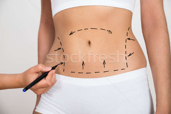 Person Hand Drawing Lines On A Woman's Abdomen Stock photo © AndreyPopov