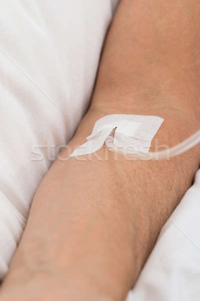 Stock photo: Close-up Of Patient's Hand