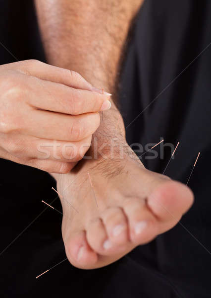 Man Getting Acupuncture Therapy Treatment Stock photo © AndreyPopov