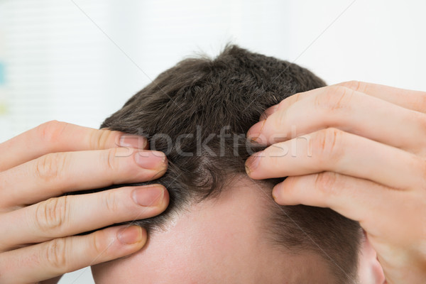 Man Checking Hairline At Home Stock photo © AndreyPopov