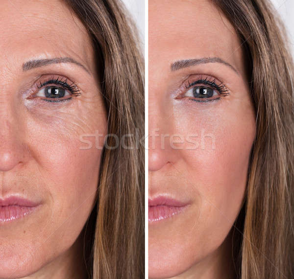 Woman With Before And After Rejuvenation Stock photo © AndreyPopov