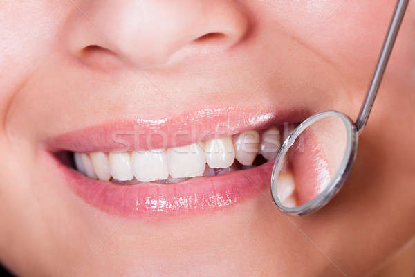 Smiling woman with perfect teeth Stock photo © AndreyPopov