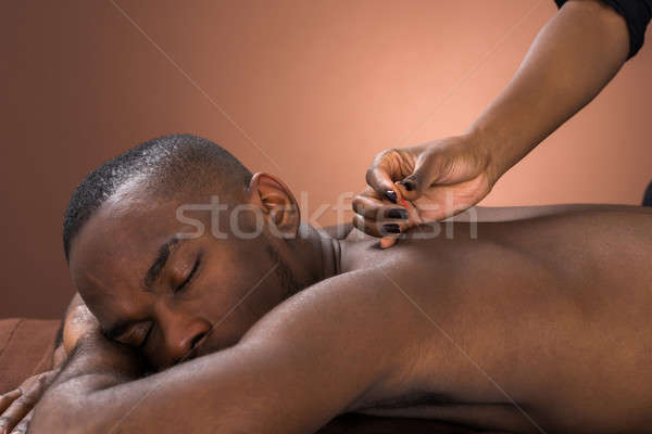 Foto stock: Moço · acupuntura · tratamento · jovem · africano · homem