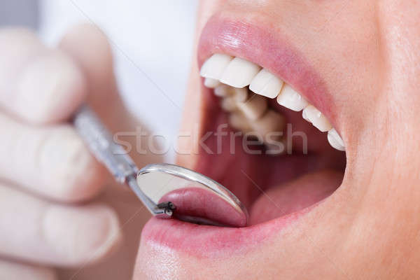 Dentista paciente feminino mão Foto stock © AndreyPopov