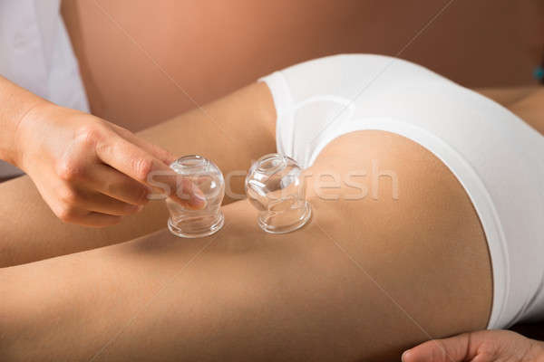 Therapist Placing Cups On Thigh Stock photo © AndreyPopov