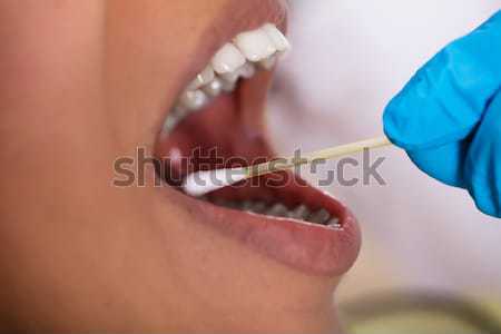 Dentist Making Saliva Test On The Mouth With Cotton Swab Stock photo © AndreyPopov
